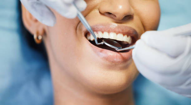 Best Lost Filling or Crown Replacement in High Bridge, NJ