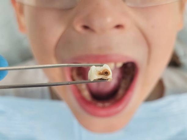 Best Emergency Care for Gum Disease in High Bridge, NJ